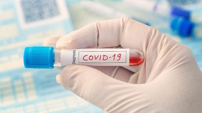 Tes Cepat PCR Aktif, 69 Laboratorium Periksa Spesimen Covid-19 di Indonesia