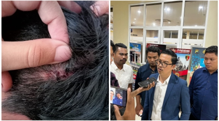 Pria Pekalongan Dianiaya Polisi, Pengacara Ungkap Sederet Kejanggalan dalam Penetapan Tersangka