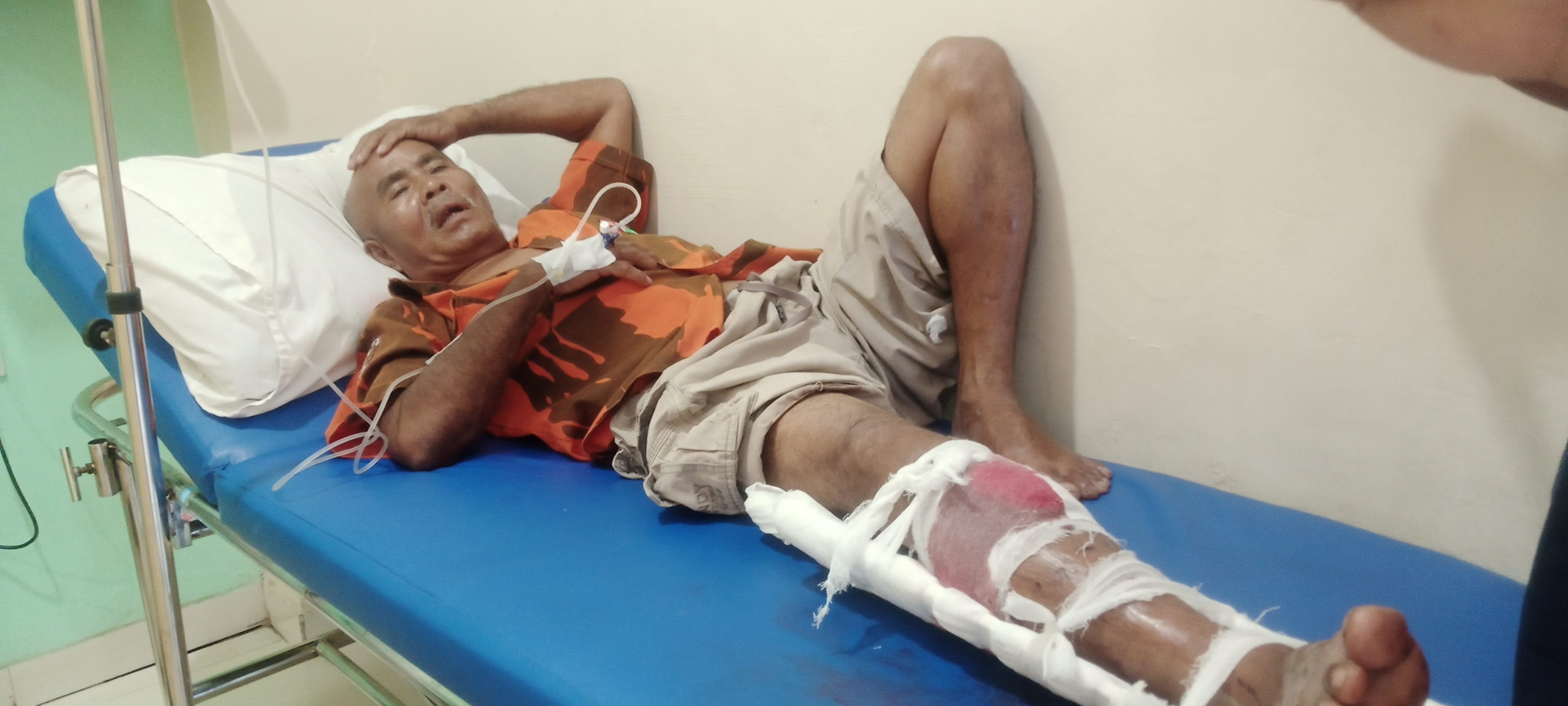 Niat Menolong Korban Kecelakaan, Kakek di Sidimpuan Malah Ditabrak Motor Hingga Patah Kaki