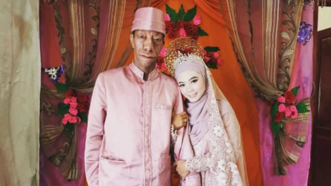 Surya Manurung, Konten Kreator Asal Asahan Menikah, Unggah Postingan Mesra Bareng Istri