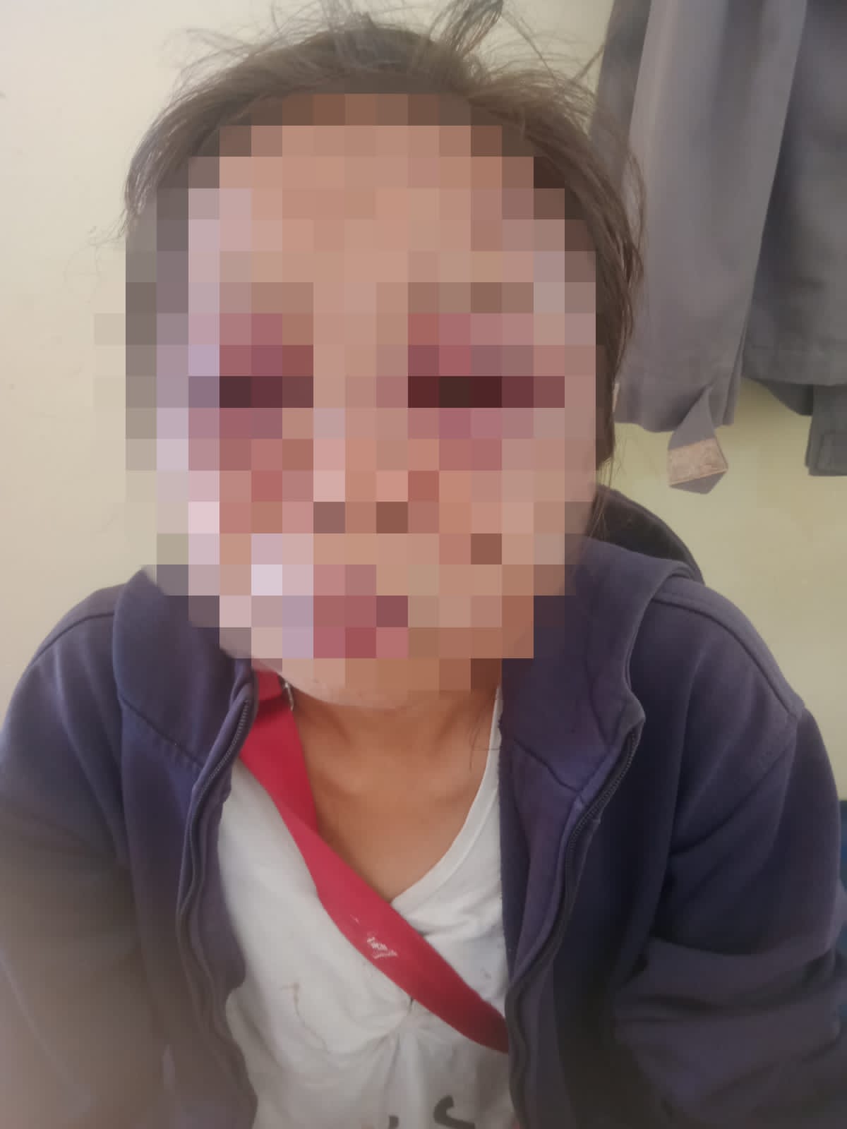 Diduga Cemburu, Pria di Rote Ndao Hajar Calon Istrinya hingga Babak Belur