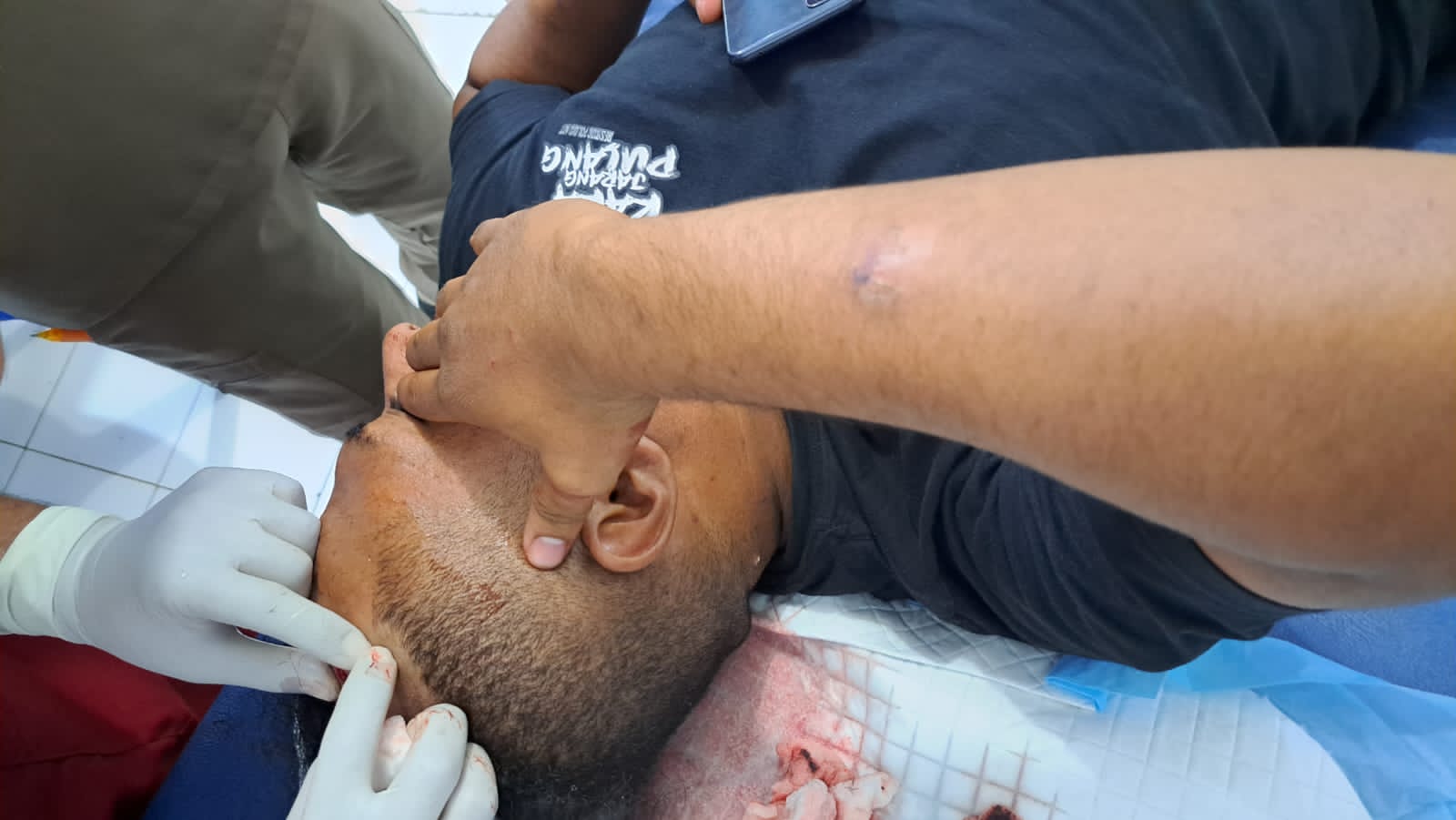 Bekuk Pelaku Penganiayaan, Polisi Terluka Diserang Massa