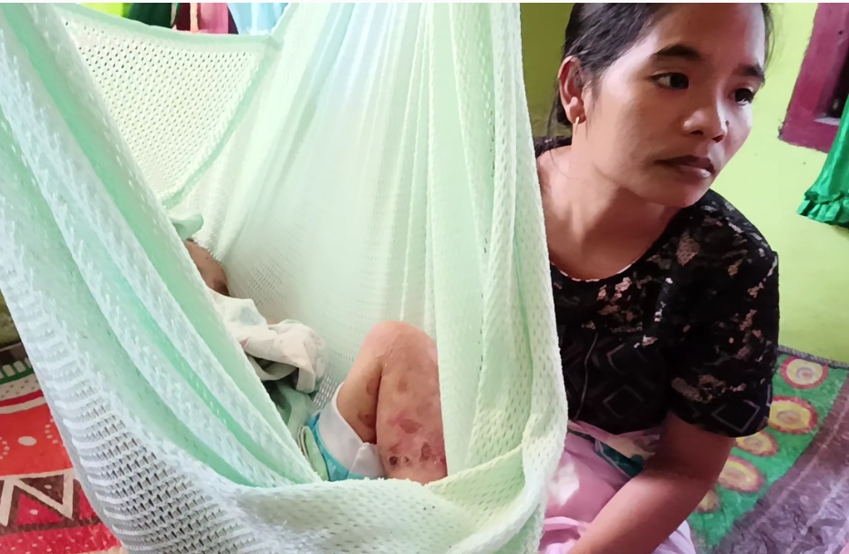 Keluarga Anaknya Derita Penyakit Langka Harapkan Bantuan Dermawan