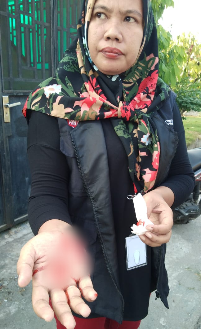 Perjuangan Pantarlih KPU Kota Binjai, Digigit Anjing Hingga Alami Kecelakaan