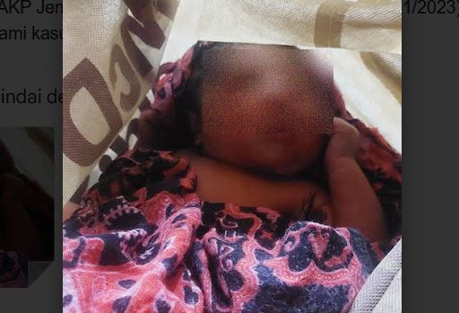Pacarnya Ditahan, Pelaku Buang Bayi di Kupang Masih Jalani Perawatan Medis