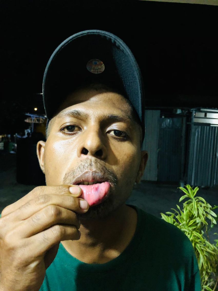 Warga di Oebufu-Kupang Diduga Dianiaya Oknum Anggota TNI AU