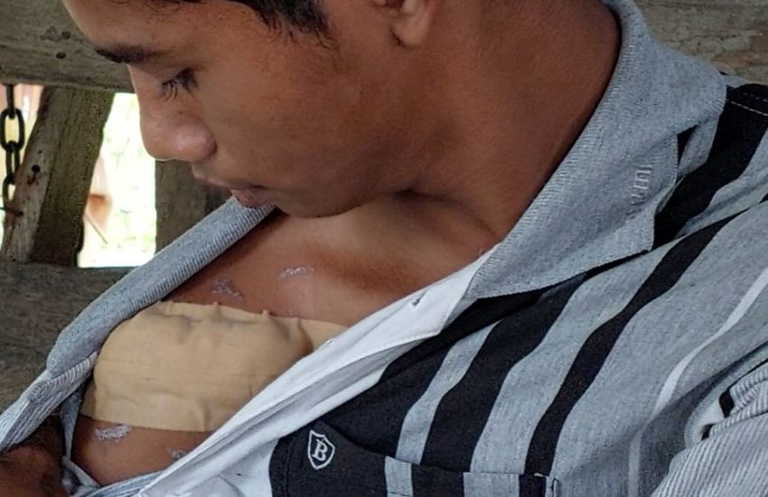 Kawanan Geng Motor Buat Resah, Remaja di Langkat Dibacok