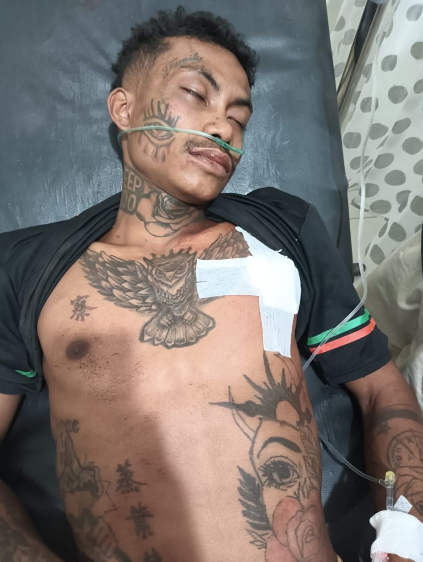 Diduga Salah Paham Saat Mabuk Miras, Petani di Kabupaten TTU Dianiaya Tiga Rekannya dengan Sajam