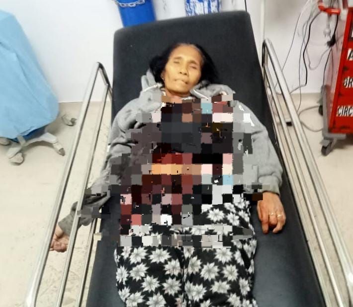 IRT Penjual Buah Di Kupang Tewas Ditikam, Anak Mantu Sekarat