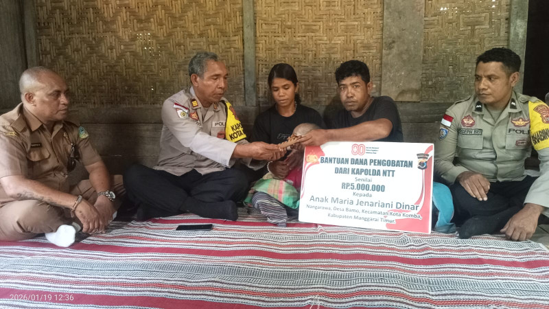 Balita Penderita Hidrosefalus di Manggarai Timur Dapat Bantuan dari Kapolda NTT